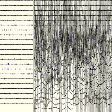 Photo by Flickr user P K Creative Commons copyright